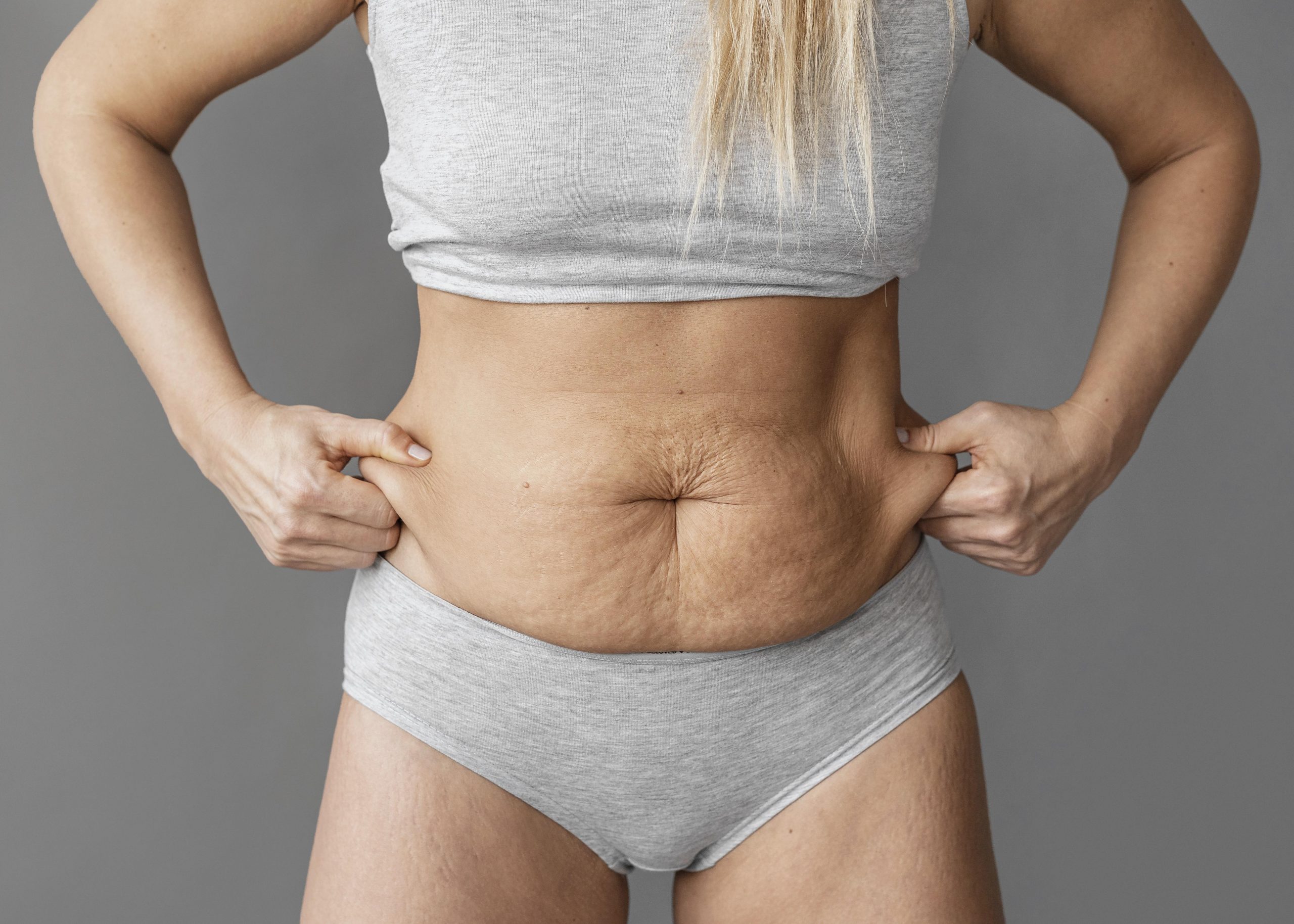 Redução de pele ou gordura na barriga: Saiba mais sobre a abdominoplastia -  Clínica Lindomar Delgado